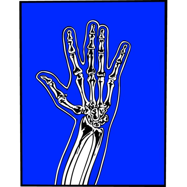 xrayM010 eps Thumbnail